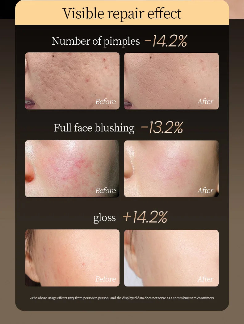 Red-light-skincare