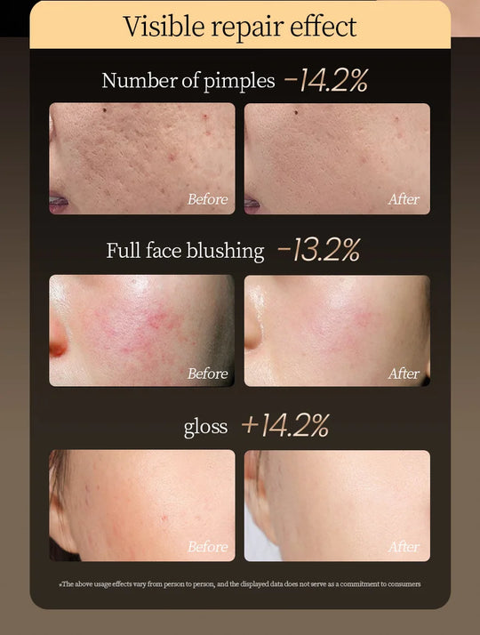 Red-light-skincare
